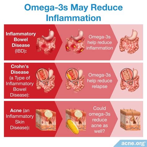 where to buy super omega for acne|omega 3 fatty acids acne.